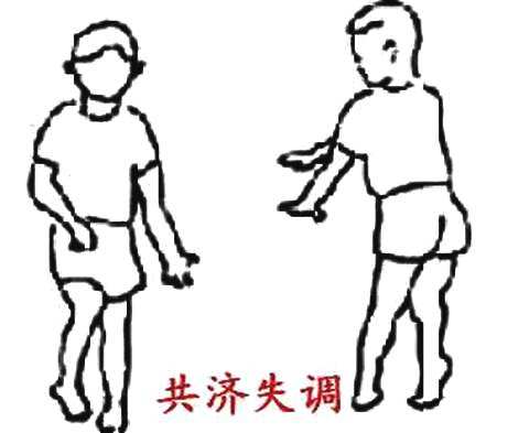 共济失调