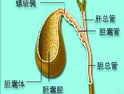 胆管癌