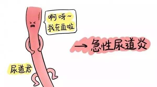 急性尿道炎