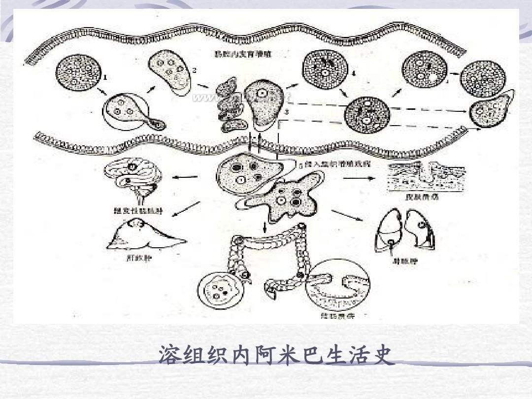 肠阿米巴病