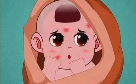 结节性红斑