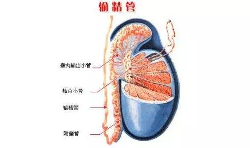 输精管堵塞