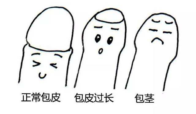 包茎
