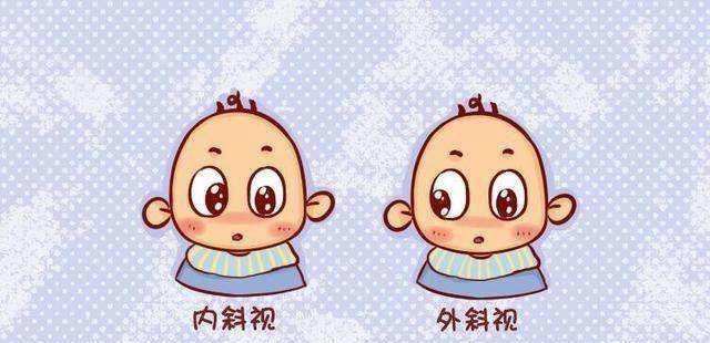 小儿斜视