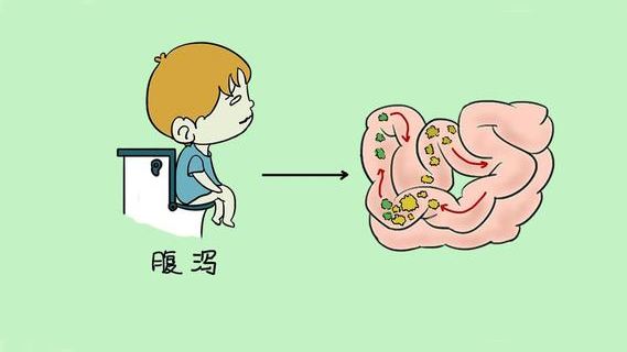 小儿腹泻