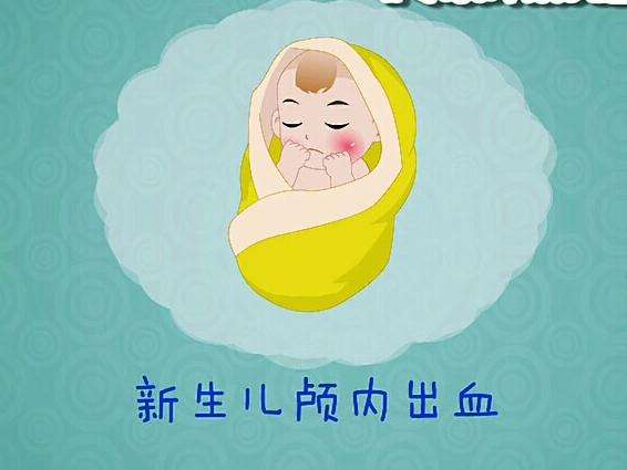 新生儿颅内出血