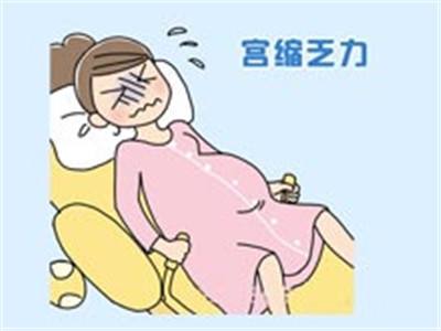 异常分娩