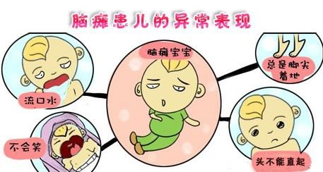 小儿脑瘫