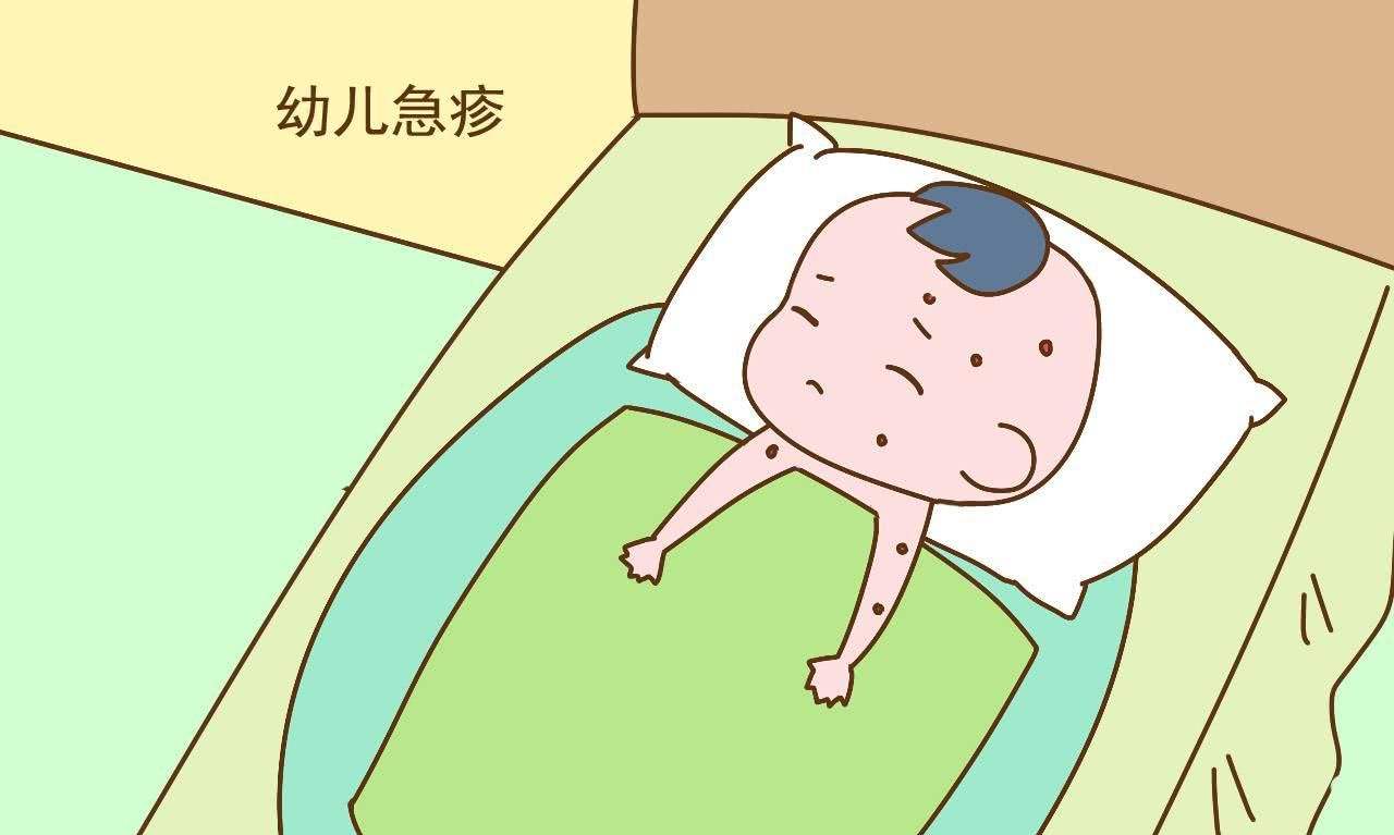 幼儿急疹