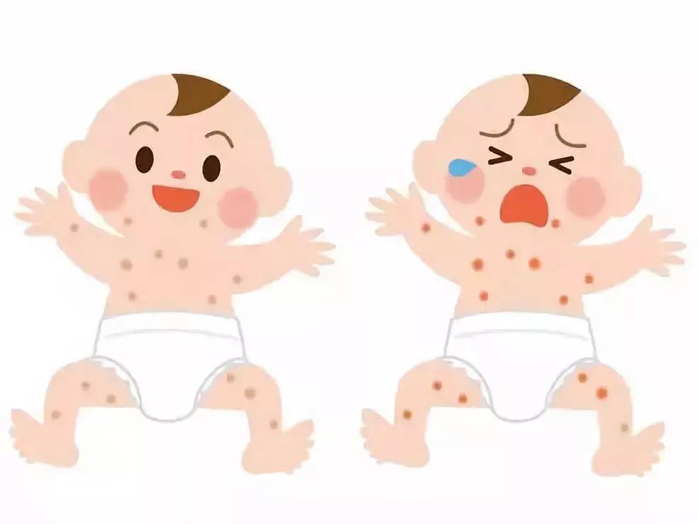 小儿类风湿病