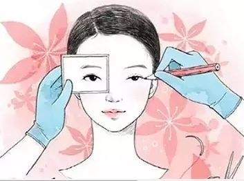 双眼皮修复