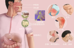 布鲁氏菌病